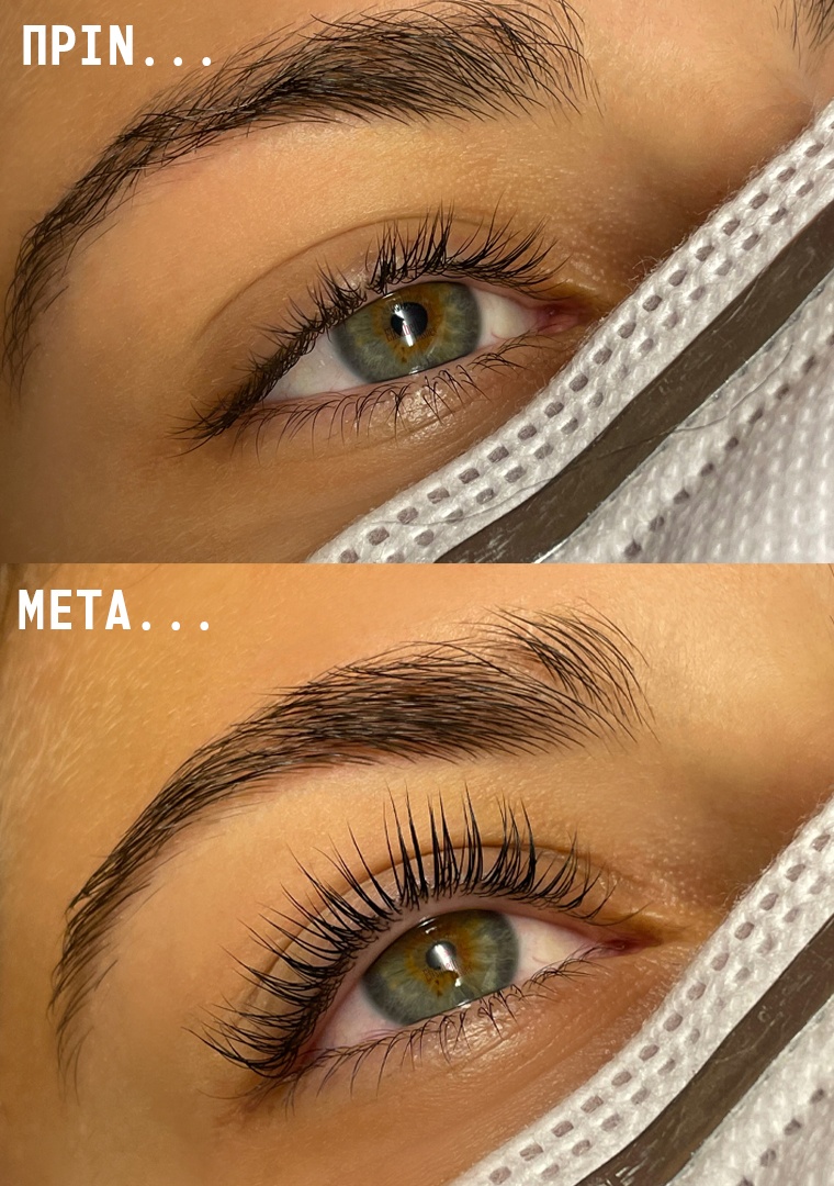 πριν-μετά lash lift